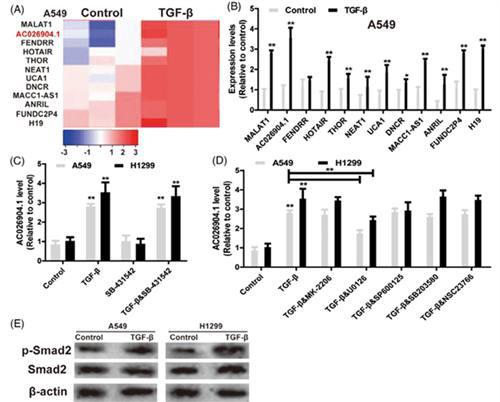 前沿研究 肺癌转移机制的新靶点lncRNAAC0269041