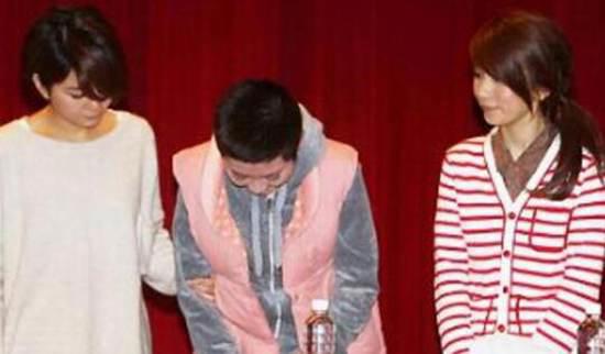 Selina烧伤前后对比照触目惊心 任家萱烧伤事件