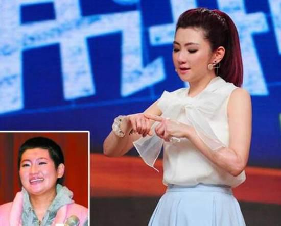 Selina烧伤前后对比照触目惊心 任家萱烧伤事件