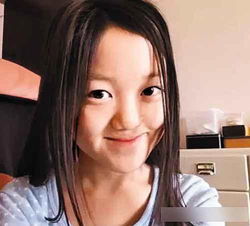 王菲女儿李嫣兔唇原因分析