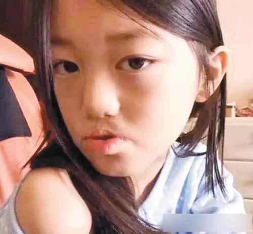 王菲女儿李嫣兔唇原因分析