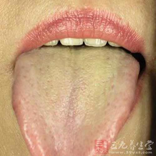 舌苔厚黄是怎么回事 舌苔厚黄是什么原因