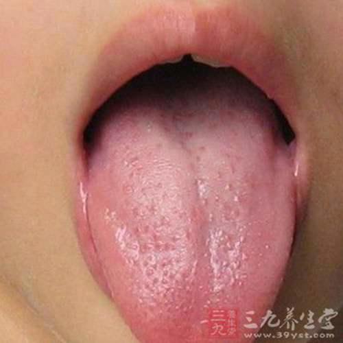 舌苔厚黄是怎么回事 舌苔厚黄是什么原因
