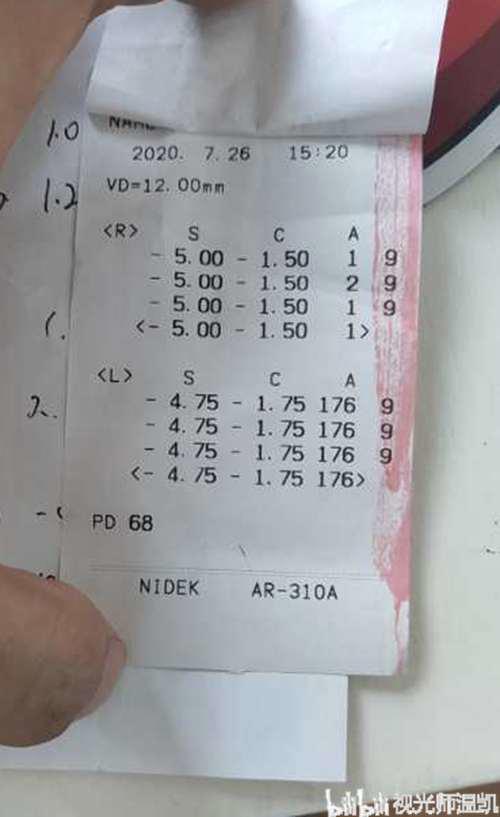 配眼镜不懂怕被坑 这篇文章帮你搞定 验光篇