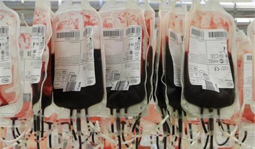 世界上有黄金血吗