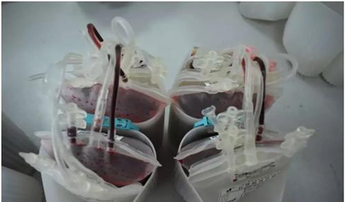 世界上有黄金血吗