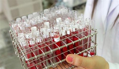 世界上有黄金血吗