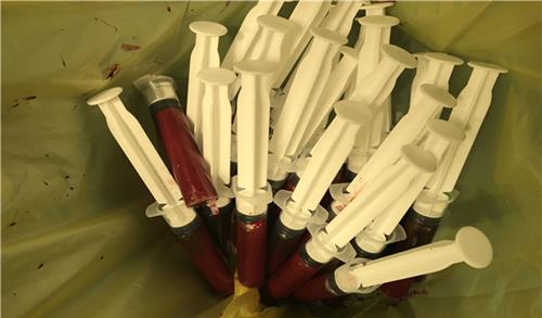 世界上有黄金血吗