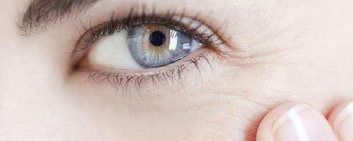 眼角鱼尾纹怎么形成的