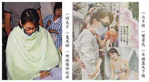 林志玲胸部盐水袋破裂事件回顾