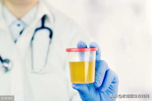 小便很黄是怎么回事