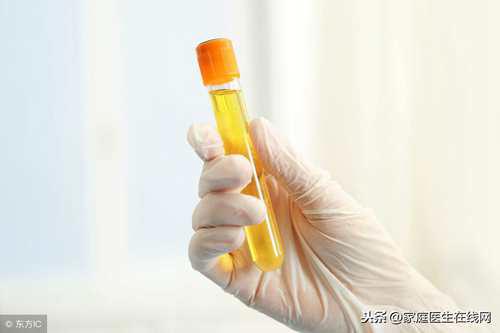 小便很黄是怎么回事