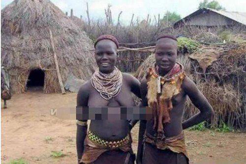 揭秘非洲象人族真相