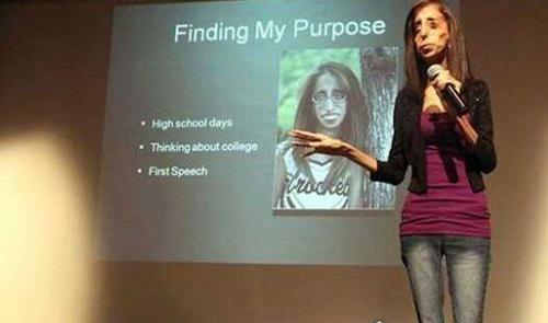 世界上最丑的人 被人们称之为骷髅女孩