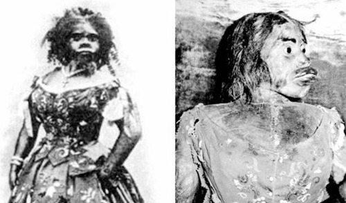 世界上最丑的人 被人们称之为骷髅女孩