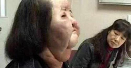 世界上最丑的人 被人们称之为骷髅女孩