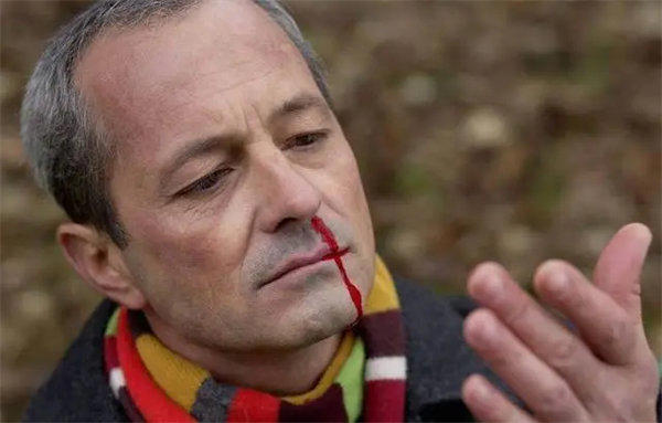 流鼻血的正确止血方法是什么(别再仰头止血了)