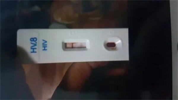 如果阳了身体会有什么症状哪些变化(每个人都应知道)