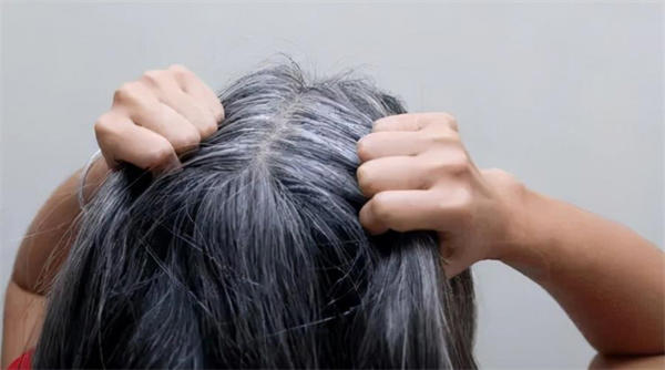 白头发长得多且快怎么办(有些生活细节要注意)