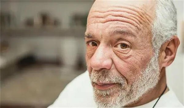 白头发长得多且快怎么办(有些生活细节要注意)