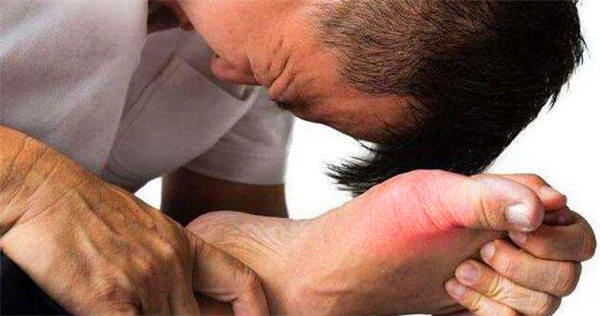 高尿酸痛风要注意什么?不仅要注意饮食,这一点更不能做