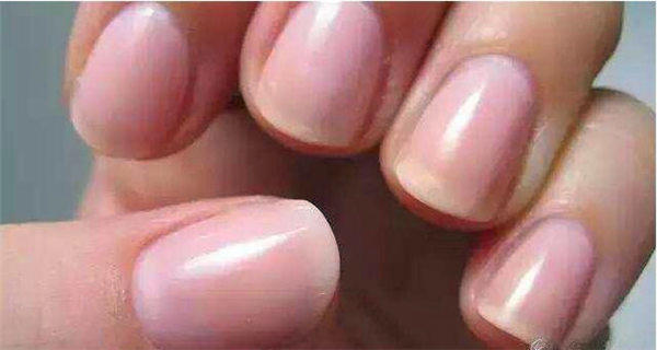 从手和脚怎么看出来肾不好？看完你也是半个医生