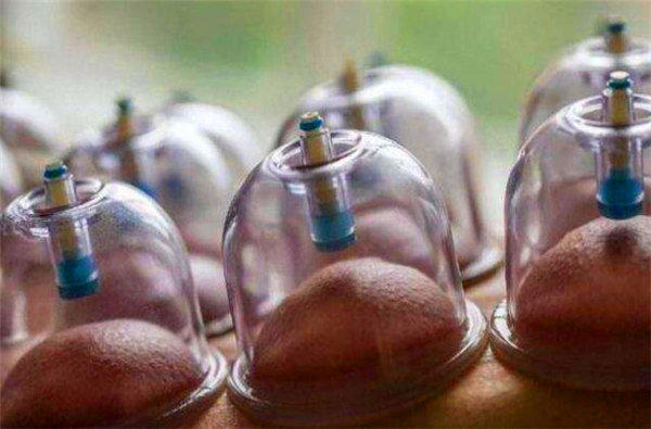 拔罐后身上的黑色印记是身体里的毒素吗？太吓人了