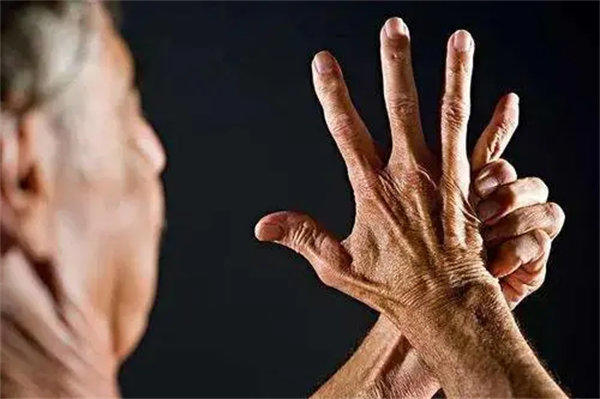 痛风能彻底治愈吗(本人亲身经历告诉你)