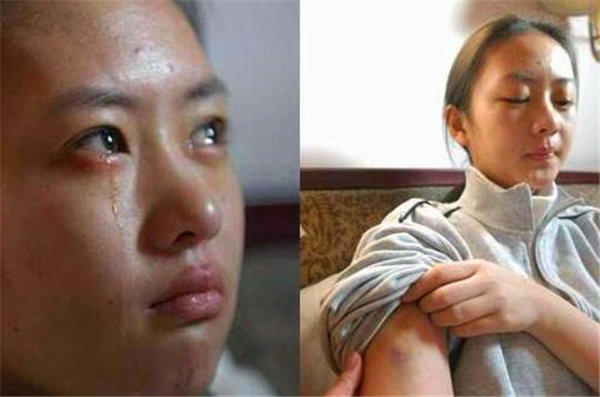 童瑶当年被张默打的原因公布，网友说打女人的男人也是渣男