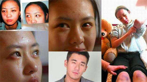 童瑶当年被张默打的原因公布，网友说打女人的男人也是渣男