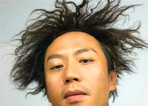 头发、胡子长得快是怎么回事？是新陈代谢快吗？