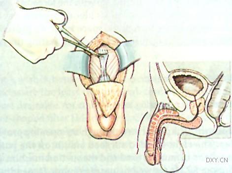 怎么能让男人变大变粗