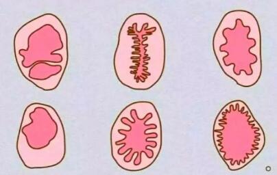 处nu膜是怎样才算破了