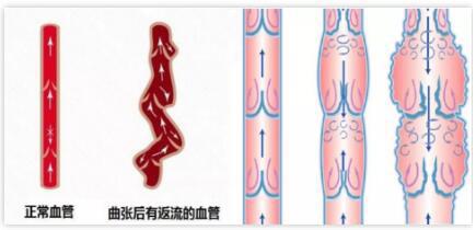 感觉男朋友蛋蛋那里一直是湿湿的是怎么回事