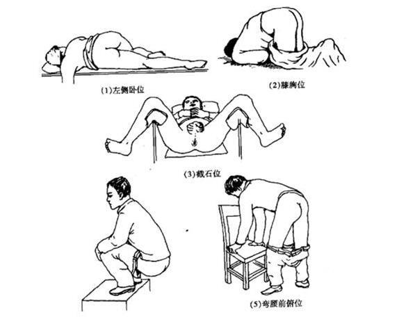 前列腺高c方法,达到前列腺高c需要弄多久