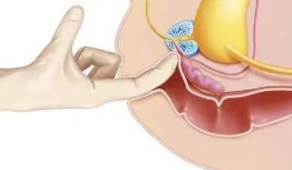 前列腺高c方法,达到前列腺高c需要弄多久