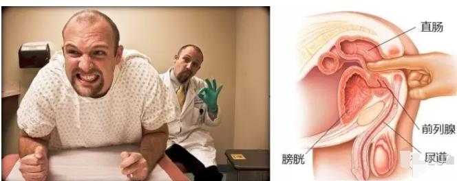 前列腺高c方法,达到前列腺高c需要弄多久