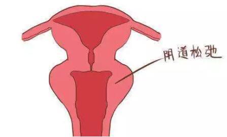 女人“下面”变松弛?4个方法学起来,做紧致女人