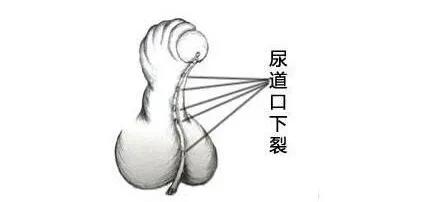 直丁丁VS弯丁丁,哪个才是好丁丁