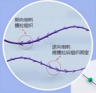 私处埋线、丁丁镶珠，真的能提升房事愉悦吗