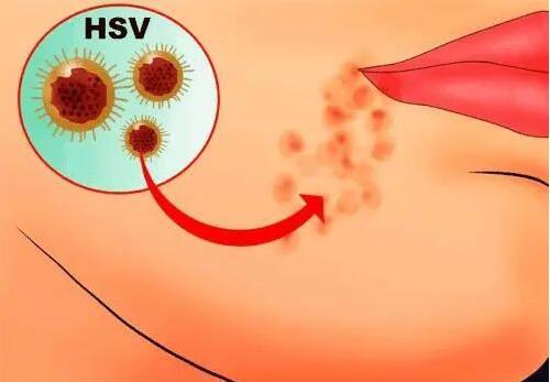 男性怎么判断自己得性疾病了