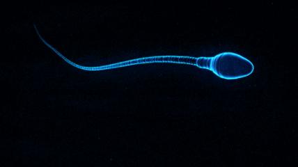 男性避孕药要来了吗?这几种避孕方法都该知道