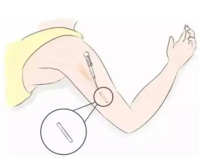 女性安全期可以不戴套?真相居然是这样……