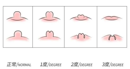 女友难以启齿的秘密:我没有乳头……