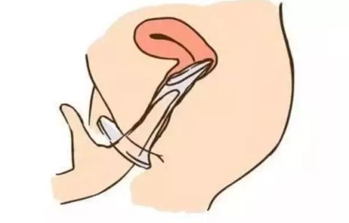 les指交套、口爱套、女用避孕套...这些另类套套你了解吗？