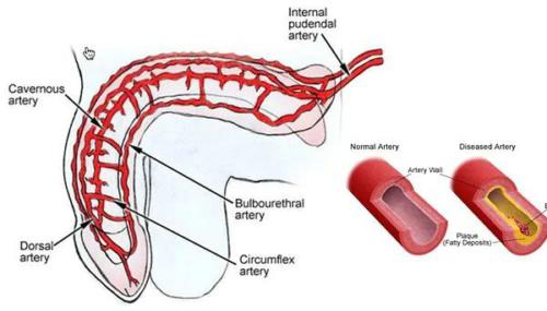 丁丁能做B超和CT吗？勃起不力这些检查挺有必要