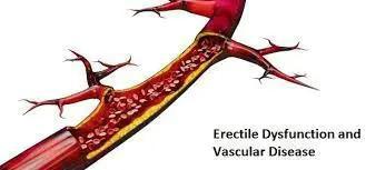 丁丁能做B超和CT吗？勃起不力这些检查挺有必要